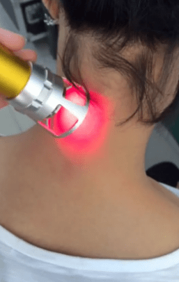 Terapia a laser