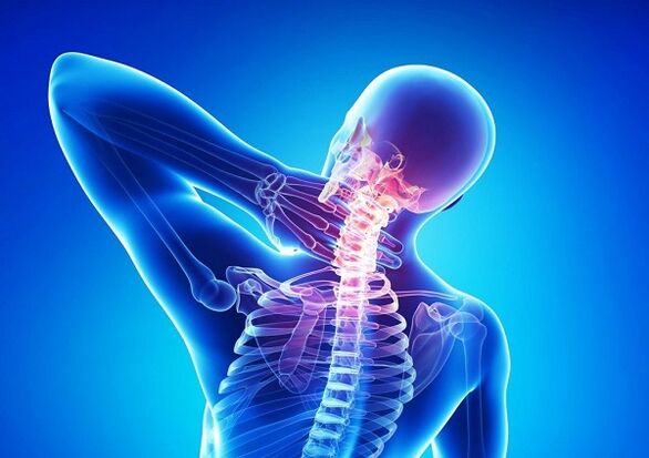dor na coluna cervical com osteocondrose