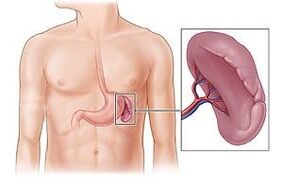 patologia do baço como causa de dor sob a omoplata esquerda