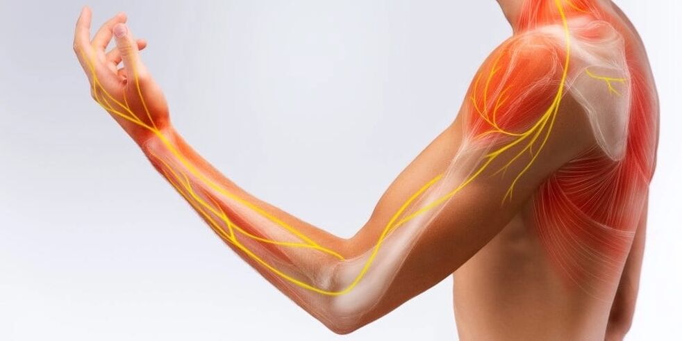 Dor e dormência nos dedos indicam danos aos ligamentos devido à ligamentite estenosante