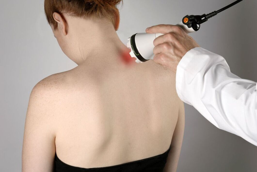 tratamento fisioterapêutico da osteocondrose cervical